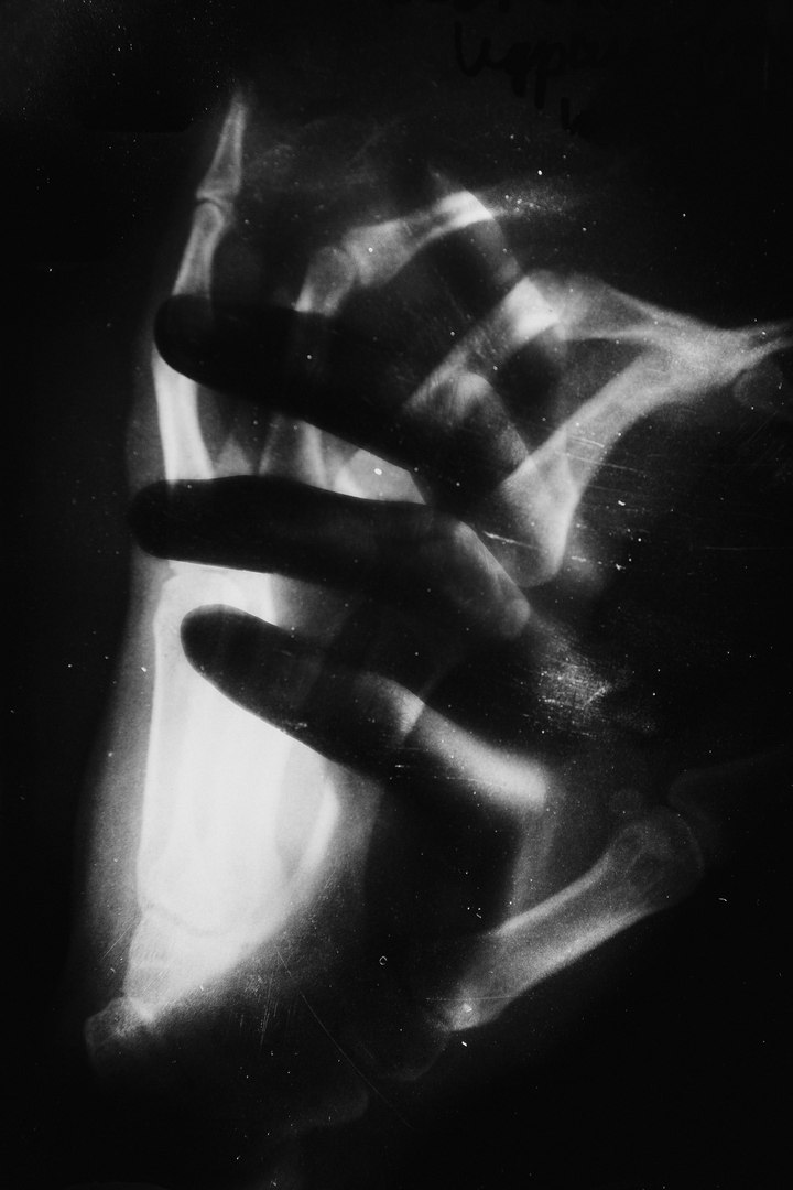 Метаморфозы Алены Ручан