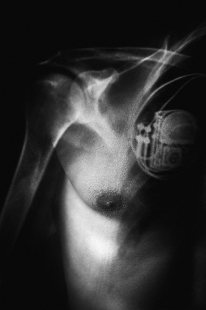 Метаморфозы Алены Ручан