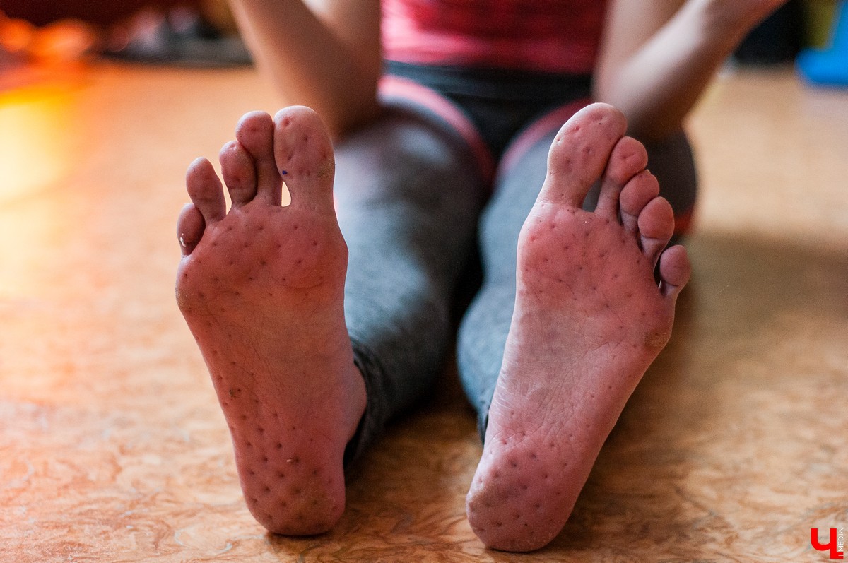 Гвоздотерапия во Владимире