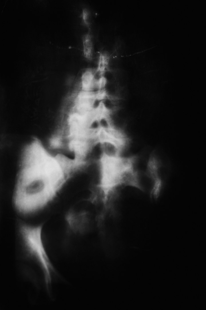 Метаморфозы Алены Ручан