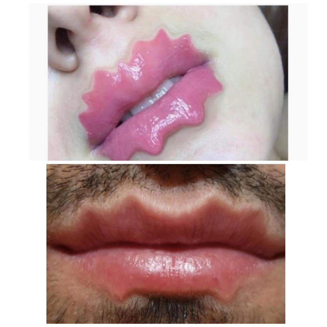 Требует ли красота жертв? Обсудили с пластическим хирургом Алексеем Филатовым бьюти-тренды и их побочные эффекты