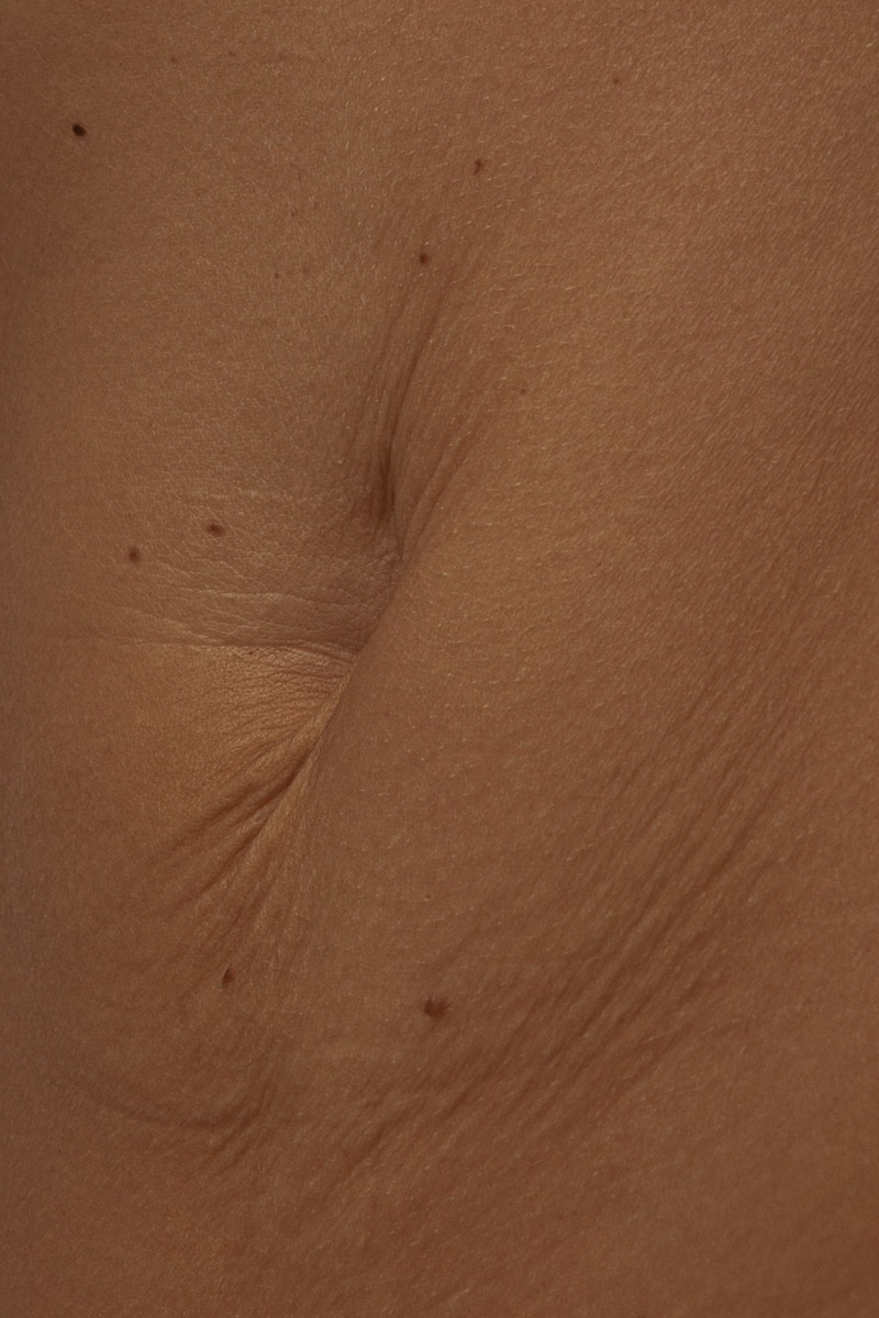 Фотограф Анастасия Зиньковская рассказала о своем проекте @a_few_naked_stories. Он посвящен принятию себя