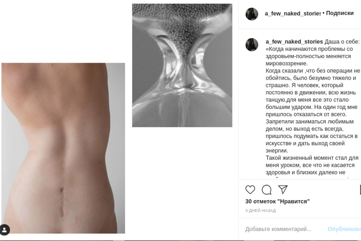 Фотограф Анастасия Зиньковская рассказала о своем проекте @a_few_naked_stories. Он посвящен принятию себя