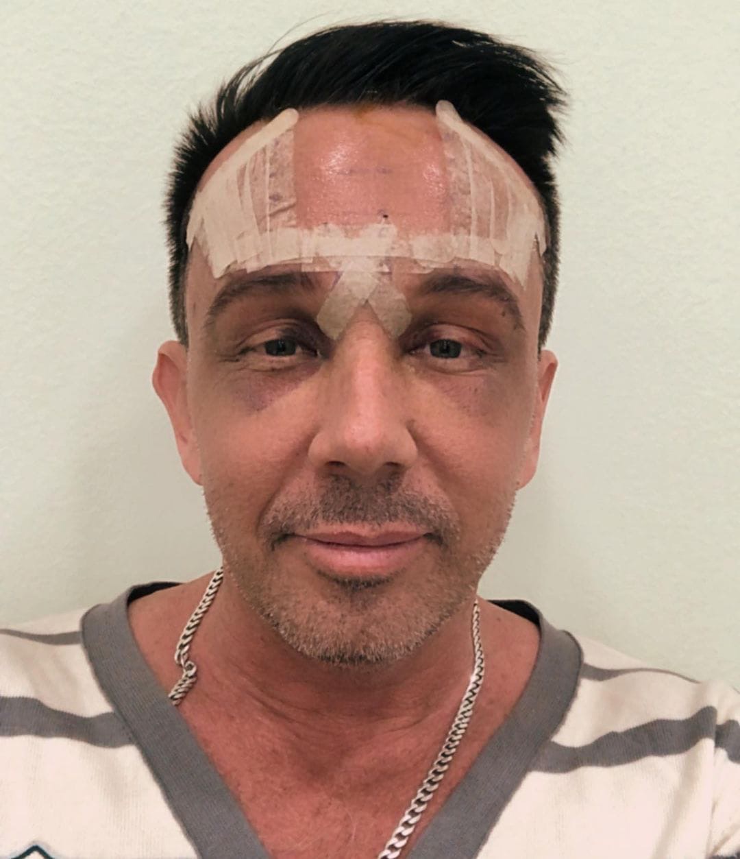 «Лечь под нож» — звучит страшно! А каково отправиться на пластическую операцию? Об этом рассказали владимирцы, которые решились на кардинальные перемены в своей жизни.