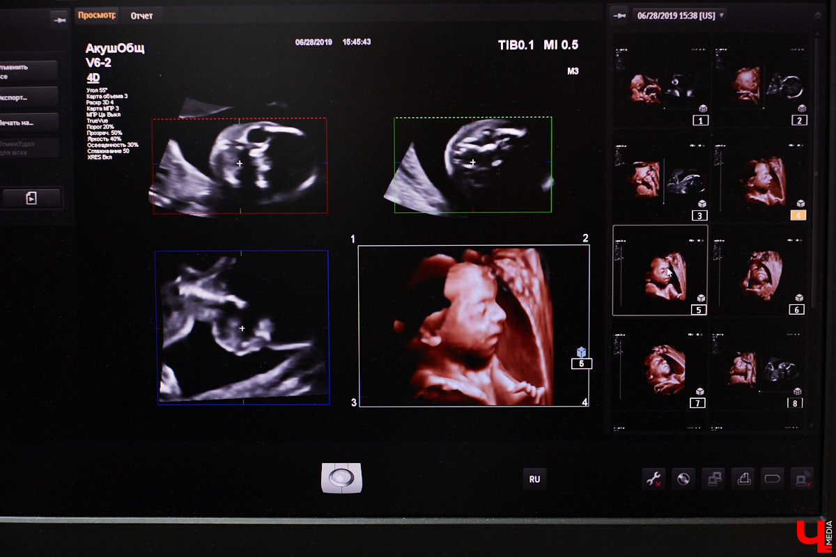 Сергей Голяков — врач широкого профиля. Гинеколог, онколог, маммолог — он каждый день сталкивается с разными пациентами и страшными для многих диагнозами. Где верная профилактика, а где стереотипы и мифы, разбирался «Ключ-Медиа».