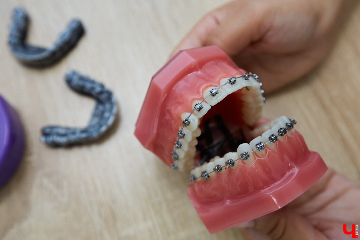 Здоровая и ровная улыбка доступны в любом возрасте. Профессионалы помогут достичь этого, подобрав элайнеры или брекет-систему. С чего начать, как проходит лечение и какова его стоимость — в разговоре со специалистом стоматологии «Лавиани».