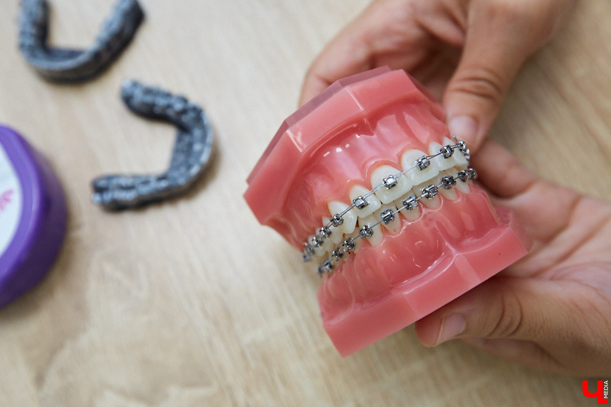 Здоровая и ровная улыбка доступны в любом возрасте. Профессионалы помогут достичь этого, подобрав элайнеры или брекет-систему. С чего начать, как проходит лечение и какова его стоимость — в разговоре со специалистом стоматологии «Лавиани».