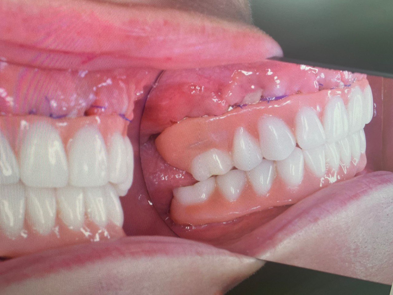 Начать новый год с новой белоснежной улыбкой — легко! Профессиональную помощь по обретению и восстановлению зубного ряда оказывают в «Лавиани». С «Ключ-Медиа» экспертным мнением на этот счет поделились врачи клиники — стоматолог-ортопед Никита Кадыков и хирург-имплантолог Алексей Комаров.