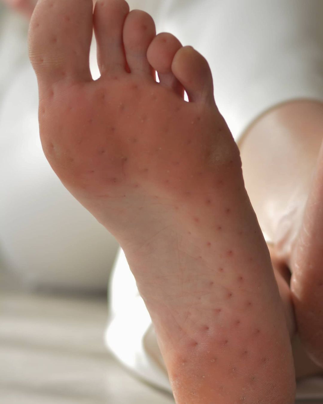 Мария Лабутина — многодетная мать, воспитывающая троих детей и вместе с мужем руководящая бизнесом в сфере общепита. Этот портрет был актуален до наступления пандемии. Коронакризис заставил супругов закрыть свое дело, так Мария радикально изменила свою жизнь и встала на гвозди.